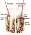 /album/periodontics/periodontics-1-jpg/